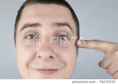 A man with different color eyes looks into the frame. The right eye is blue and the left is green. Heterochromia. Gene mutation. Multi-colored eyes. A man with different color eyes looks into the frame. The right eye is blue and the left is green. Heterochromia. Gene mutation. Multi-colored eyes. 78270310