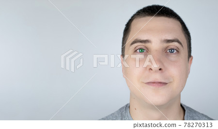 A man with different color eyes looks into the frame. The right eye is blue and the left is green. Heterochromia. Gene mutation. Multi-colored eyes. A man with different color eyes looks into the frame. The right eye is blue and the left is green. Heterochromia. Gene mutation. Multi-colored eyes. 78270313