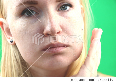 Teeth Problem. Gumboil, flux and swelling of the cheek. Closeup Of Beautiful Sad Girl Suffering From Strong Tooth Pain. Attractive Female Feeling Painful Toothache, Dental Health And Care Concept Teeth Problem. Gumboil, flux and swelling of the cheek. Closeup Of Beautiful Sad Girl Suffering From Strong Tooth Pain. Attractive Female Feeling Painful Toothache, Dental Health And Care Concept 78272119