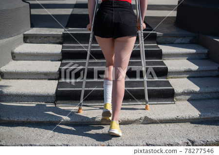 Young woman with ankle injury climbs stairs on crutches. Young woman with ankle injury climbs stairs on crutches. 78277546