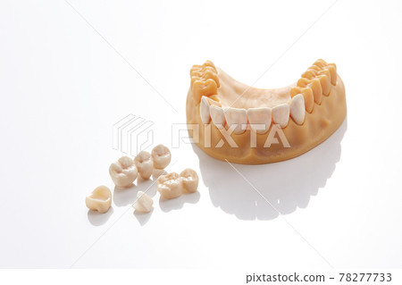 Dental model 78277733