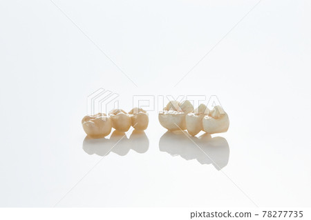 Dental model 78277735