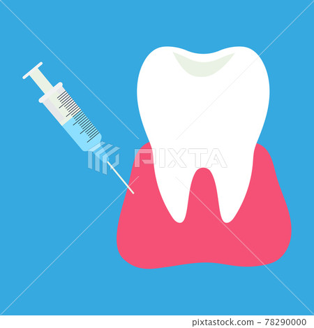 injection of anesthesia for treatment of tooth 78290000