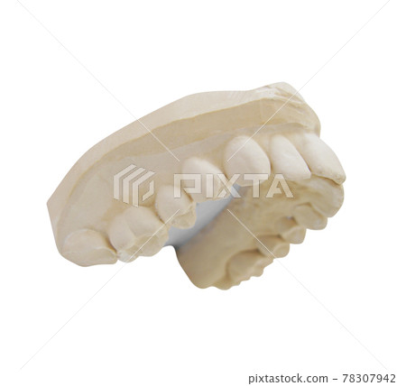 teeth mold isolated on white teeth mold isolated on white 78307942