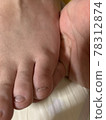 無限小的小指甲 78312874