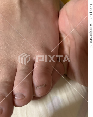 無限小的小指甲 78312874