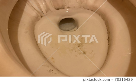 Darkening of the toilet bowl of Western style toilet 78316429