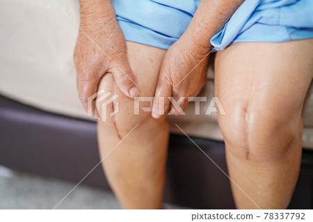 Asian senior or elderly old lady woman patient show her scars surgical total knee joint replacement Suture wound surgery arthroplasty on bed in nursing hospital ward : healthy strong medical concept.. 78337792