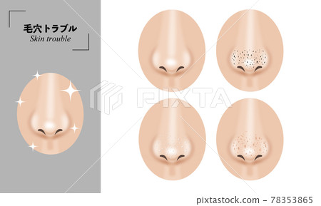 Worries about pores 78353865