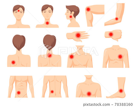 Focus of pain set Focus of pain set 78388160