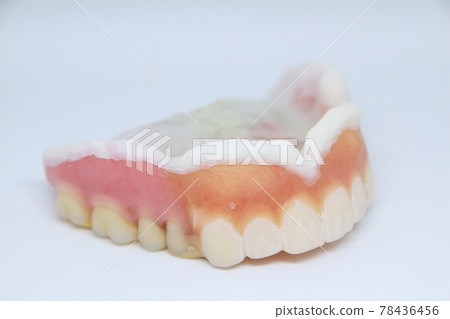 臨時假牙直到治療結束,因為它們不適合,它們被襯里和修復 臨時假牙直到治療結束,因為它們不適合,它們被襯里和修復 78436456