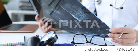 Female doctor holding x-ray in her hands in clinic closeup 78465148