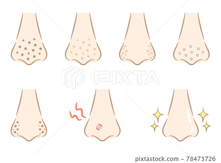 Illustration of dirt on the pores of the nose Fashionable touch 78473726