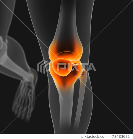 3D_Illustration_Knee_painful_human_skeleton_medical_concept_front_angle 78483621