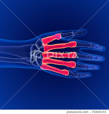 Human skeleton anatomy Metacarpals Bones Dorsal side 3D Rendering For Medical Concept 78484141
