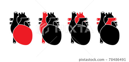Human heart with red selected parts. Anatomically correct organ illustration. Human heart with red selected parts. Anatomically correct organ illustration. 78486491