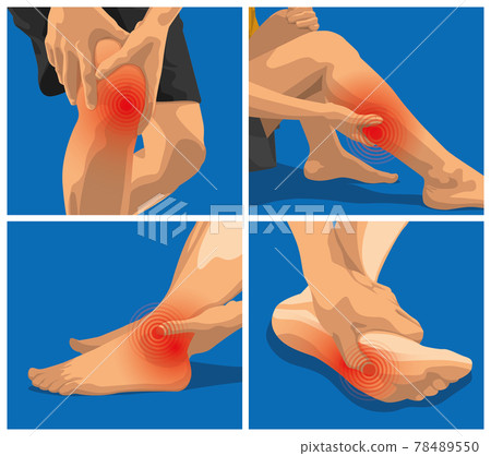 疼痛設定。膝蓋、小腿、腳踝和腳底疼痛的女性。 疼痛設定。膝蓋、小腿、腳踝和腳底疼痛的女性。 78489550