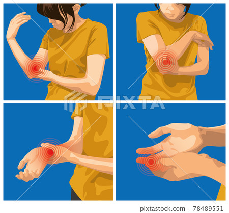 疼痛設定。女性手臂、手肘、手腕和手指疼痛。 疼痛設定。女性手臂、手肘、手腕和手指疼痛。 78489551