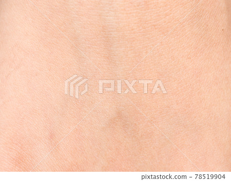 Skin texture 78519904