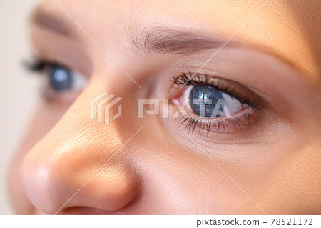 Close up of imperfect face of woman without makeup Close up of imperfect face of woman without makeup 78521172