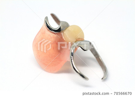 General partial dentures (dentures) using metal springs and resin General partial dentures (dentures) using metal springs and resin 78566670