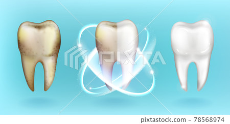 Clean and dirty tooth, whitening or clearing teeth Clean and dirty tooth, whitening or clearing teeth 78568974