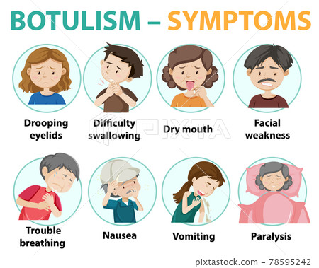 Botulism symptoms information infographic 78595242