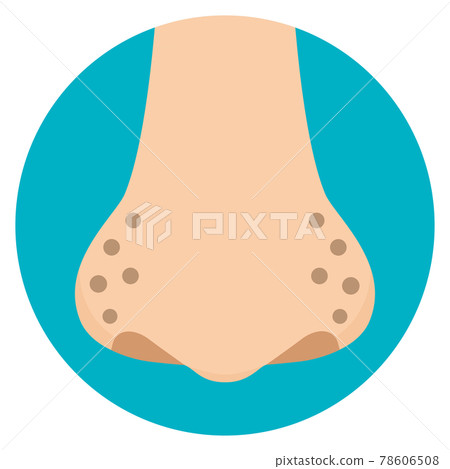 Dirty illustration of nose pores, darkening of the nose, flat design Dirty illustration of nose pores, darkening of the nose, flat design 78606508