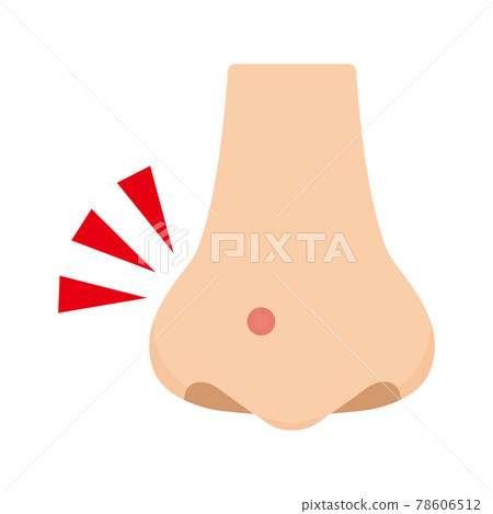 Illustration of acne on the nose Illustration of acne on the nose 78606512
