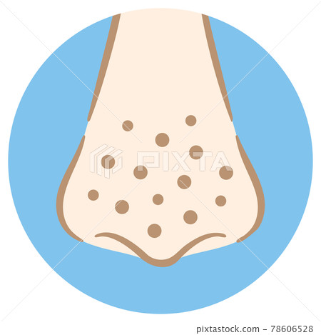 鼻孔臟圖草莓鼻子手繪風格 78606528