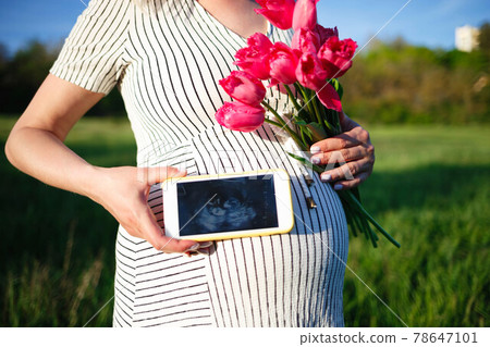 woman's hand holding an ultrasound scan on the background of a pregnant belly 78647101
