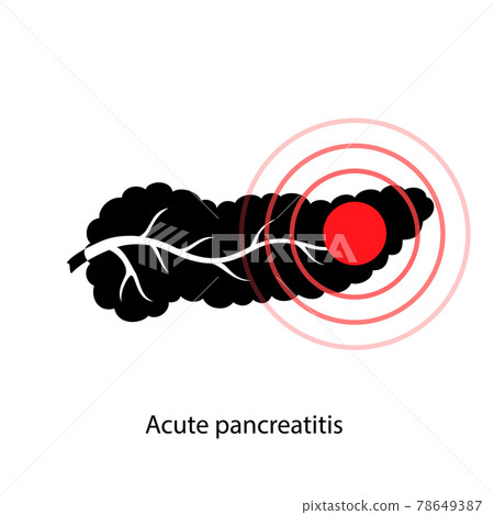Pancreas disease and cancer 78649387