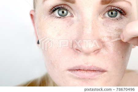 The girl removes the mask film from the face. The concept of removing old dry skin, self-care 78670496
