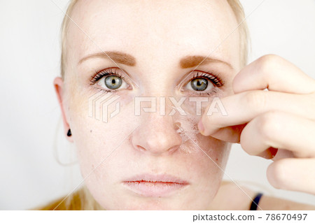 The girl removes the mask film from the face. The concept of removing old dry skin, self-care The girl removes the mask film from the face. The concept of removing old dry skin, self-care 78670497