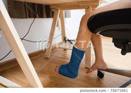 Injured woman of broken leg in plaster cast working at wood desk Injured woman of broken leg in plaster cast working at wood desk 78671661