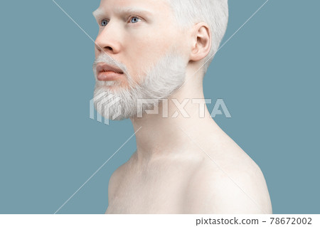 Abnormal deviations, unusual appearance. Thin albino guy posing without t-shirt and lookig aside, turquoise background. 78672002