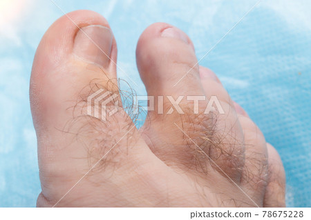 Hairiness on the toes of a person, macro. Hygiene and cosmetology concept, hair removal Hairiness on the toes of a person, macro. Hygiene and cosmetology concept, hair removal 78675228