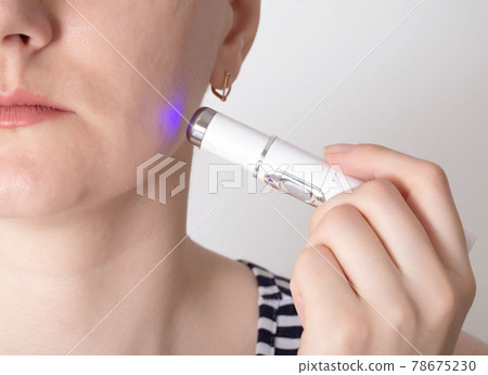 Treatment and removal of inflamed red acne and wrinkles from the cheeks of the girl's face. Modern procedure for laser cleaning of facial skin. Copy space for text Treatment and removal of inflamed red acne and wrinkles from the cheeks of the girl's face. Modern procedure for laser cleaning of facial skin. Copy space for text 78675230