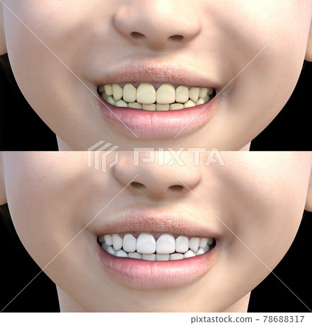 美白圖像牙齒美白燙髮3DCG插圖素材 78688317