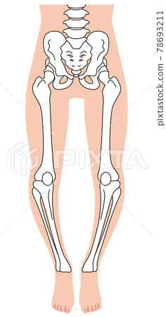 O型腿骨骼、骨盆扭曲、腿骨 78693211