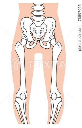 O型腿骨骼、骨盆扭曲、腿骨 78697025