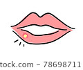 Herpes labialis illustration 78698711