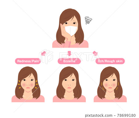 Illustration of skin troubles caused by wearing a mask / Skin care (new coronavirus) | English Illustration of skin troubles caused by wearing a mask / Skin care (new coronavirus) | English 78699180
