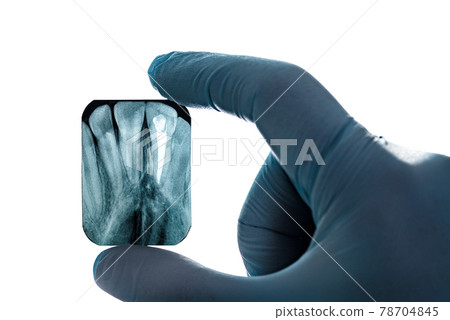 Radiography imaging upper canines root canal hand in glove isolated 78704845