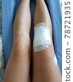 膝蓋受傷的腿 78721935