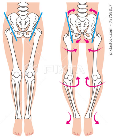 Pelvis and skeleton O-leg skeleton Pelvic distortion Pelvis and skeleton O-leg skeleton Pelvic distortion 78759817