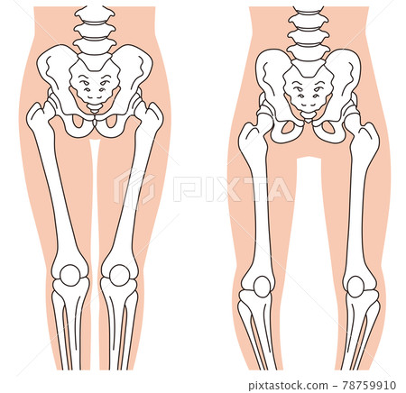 Pelvis and skeleton O-leg skeleton Pelvic distortion Pelvis and skeleton O-leg skeleton Pelvic distortion 78759910