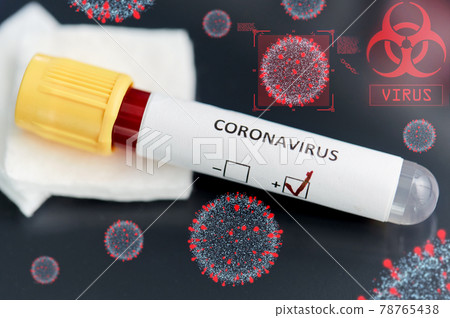 beaker with coronavirus blood test beaker with coronavirus blood test 78765438