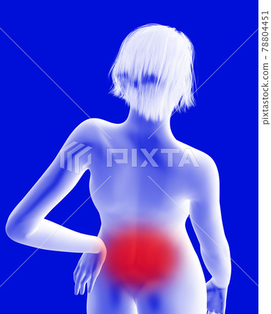 Low back pain Low back pain 78804451