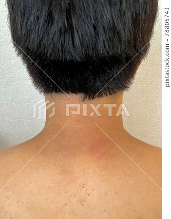 A man with an uneven neckline A man with an uneven neckline 78805741
